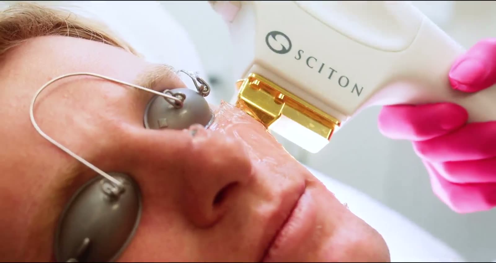 Laser treatment at La Jolla Laser Derm in La Jolla, California